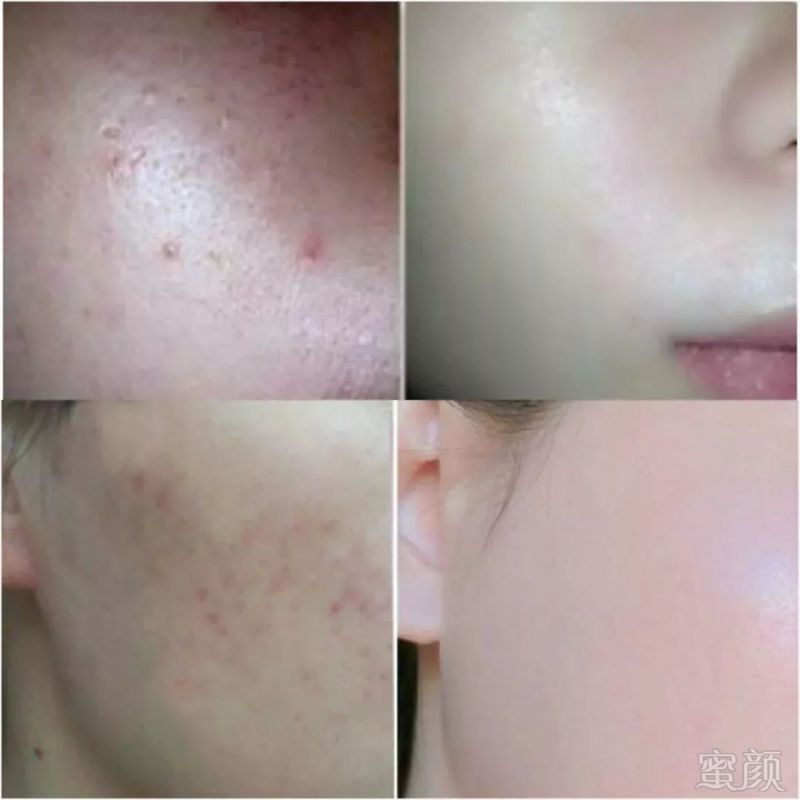 https://img.miyanlife.com/mnt/timg/180717/11511W955-12.jpg