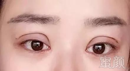 https://img.miyanlife.com/mnt/timg/180717/11521244C-4.jpg