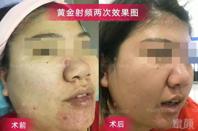 https://img.miyanlife.com/mnt/timg/180717/11521964b-7.jpg