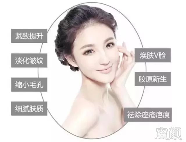 https://img.miyanlife.com/mnt/timg/180717/11521C4Y-4.jpg