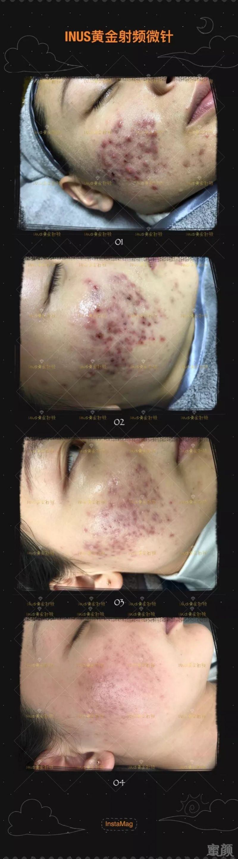 https://img.miyanlife.com/mnt/timg/180717/11521KM0-6.jpg