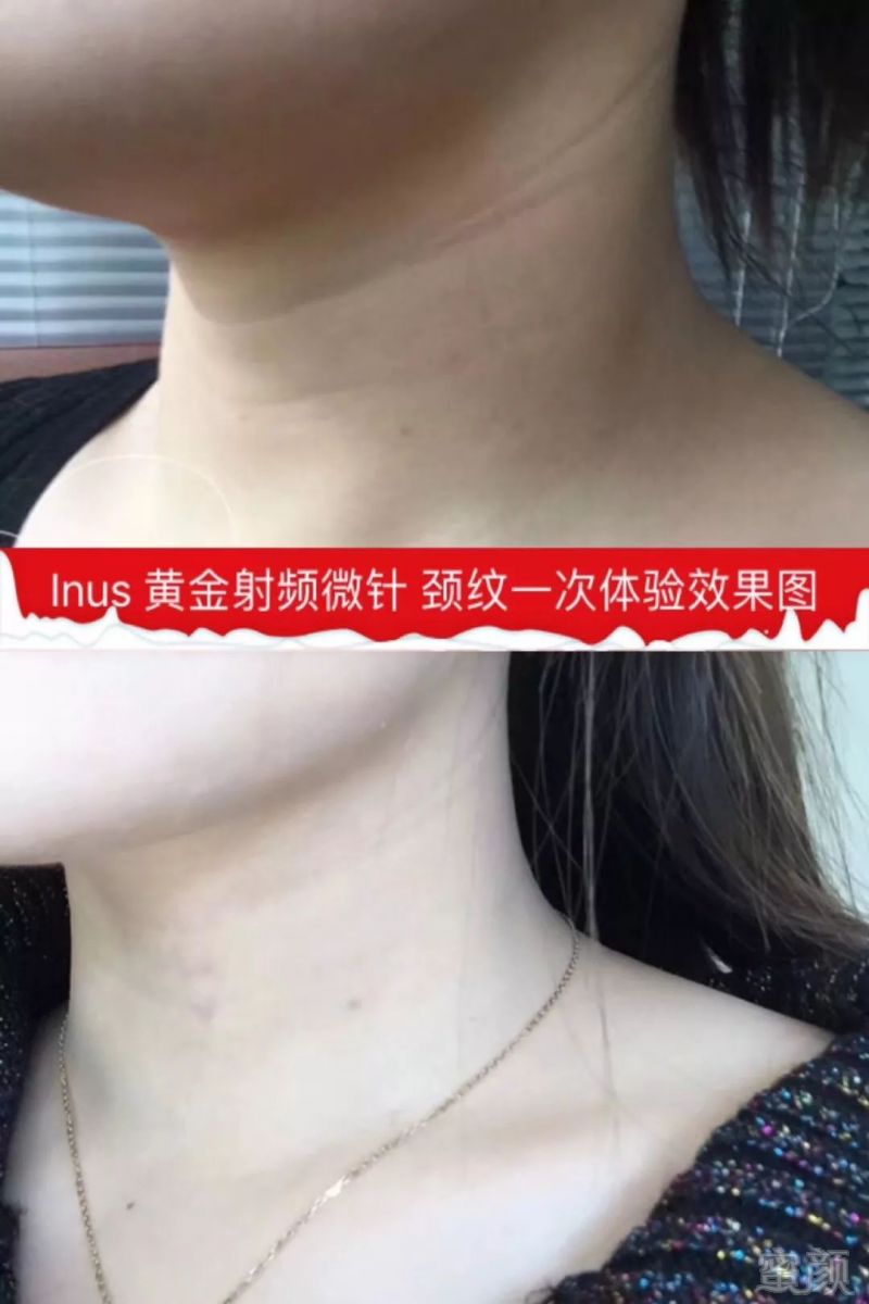 https://img.miyanlife.com/mnt/timg/180717/1152243195-9.jpg