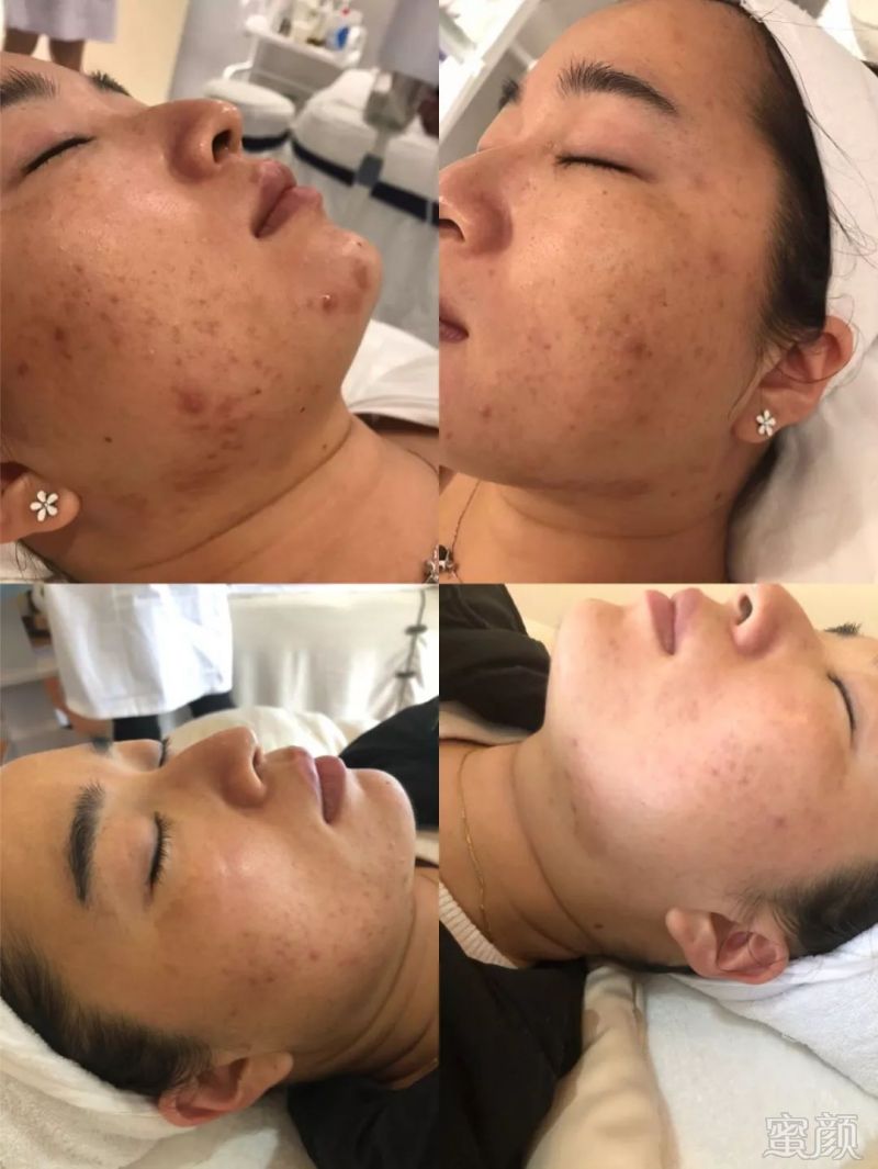 https://img.miyanlife.com/mnt/timg/180717/1152291306-14.jpg