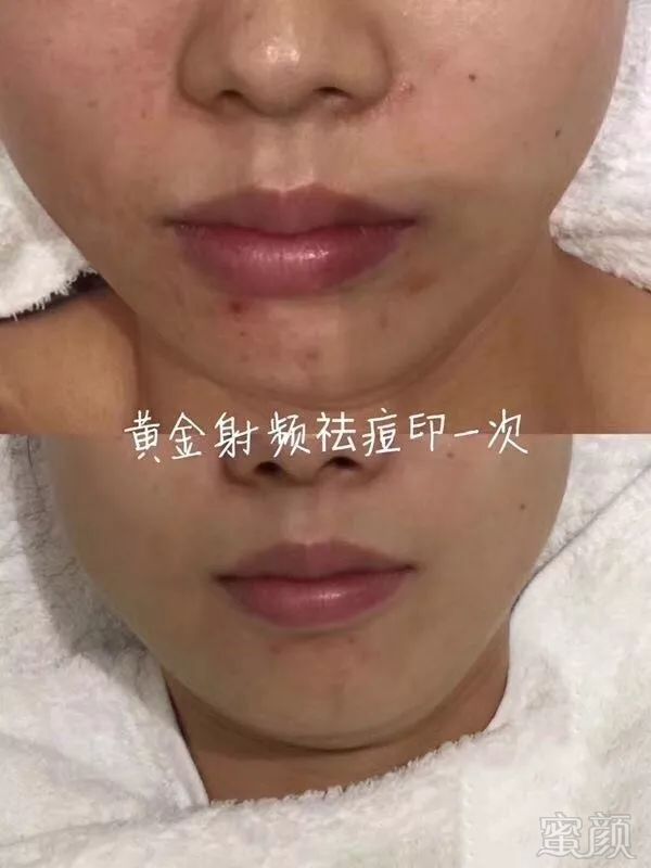 https://img.miyanlife.com/mnt/timg/180717/1152296094-13.jpg