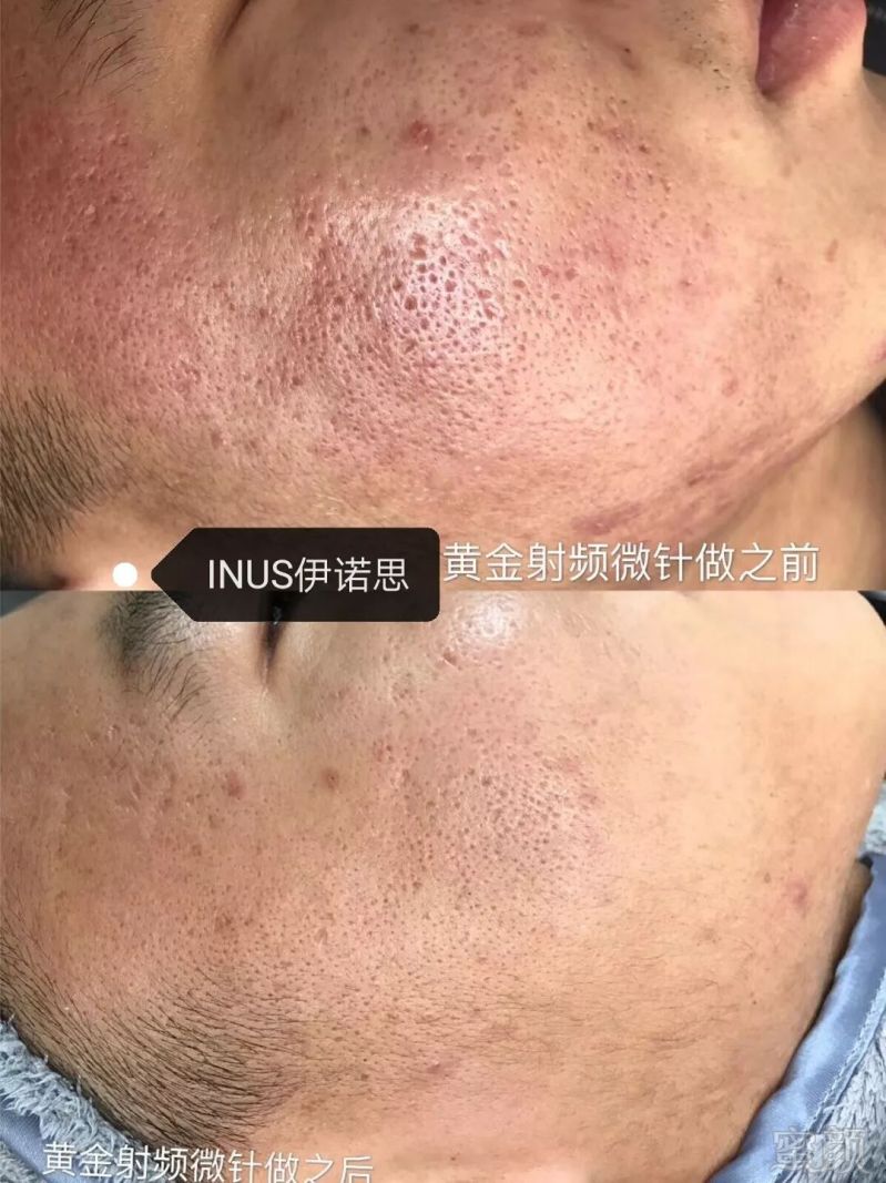 https://img.miyanlife.com/mnt/timg/180717/11522AY9-11.jpg