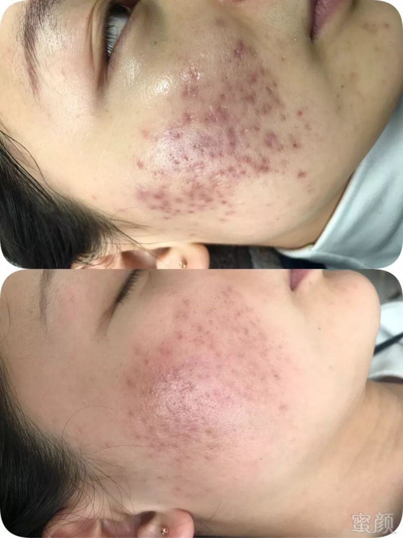 https://img.miyanlife.com/mnt/timg/180717/11522W921-12.jpg