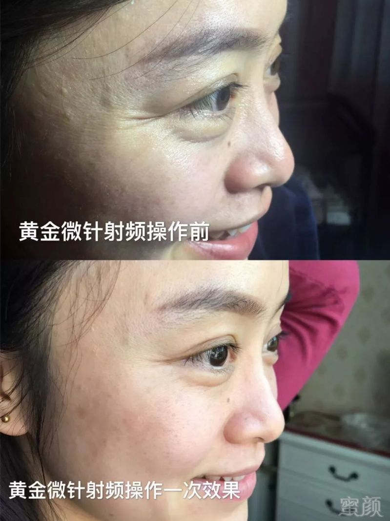 https://img.miyanlife.com/mnt/timg/180717/11523020K-15.jpg