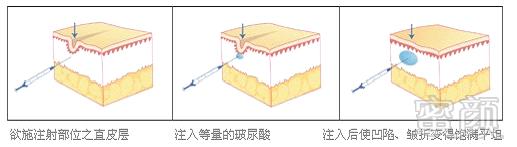 案例图片