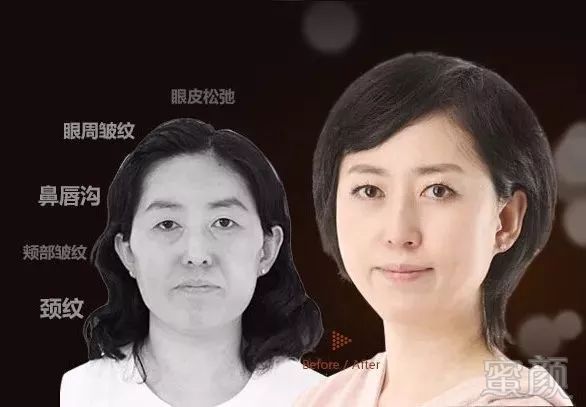 https://img.miyanlife.com/mnt/timg/180717/120543DW-15.jpg