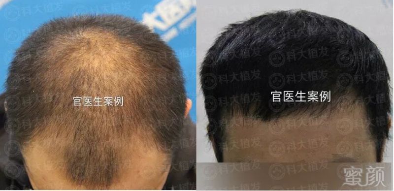 https://img.miyanlife.com/mnt/timg/180717/120H35930-0.jpg