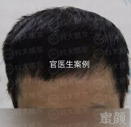 https://img.miyanlife.com/mnt/timg/180717/120H4H32-3.jpg