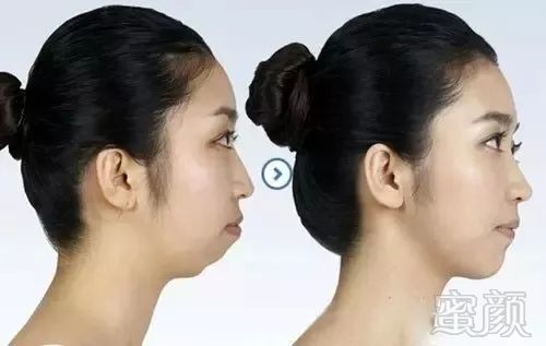 https://img.miyanlife.com/mnt/timg/180717/12120a435-7.jpg