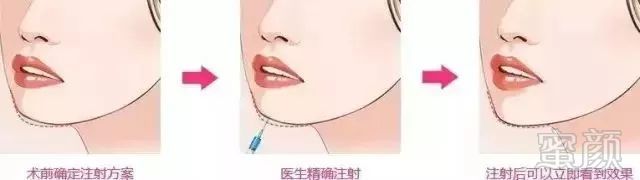 https://img.miyanlife.com/mnt/timg/180717/1212104295-12.jpg