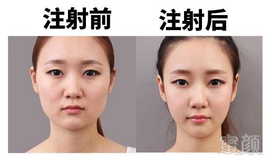 https://img.miyanlife.com/mnt/timg/180717/1212106326-14.jpg