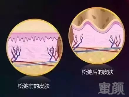https://img.miyanlife.com/mnt/timg/180717/121Q22154-3.jpg