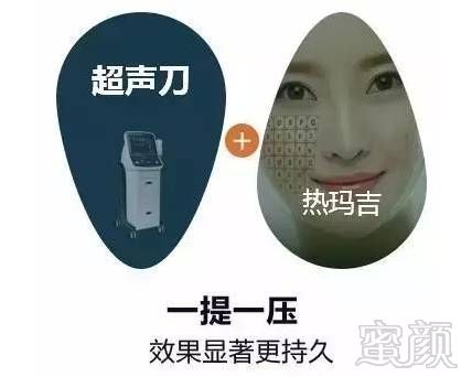 https://img.miyanlife.com/mnt/timg/180717/121Q25458-4.jpg
