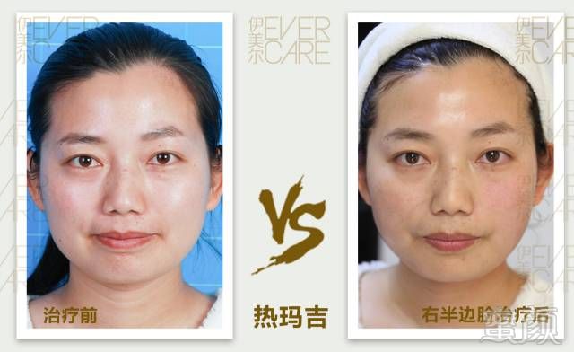 https://img.miyanlife.com/mnt/timg/180718/1156052D9-13.jpg