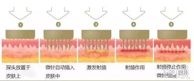 https://img.miyanlife.com/mnt/timg/180718/1206215010-13.jpg