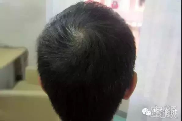 https://img.miyanlife.com/mnt/timg/180718/121G05020-5.jpg