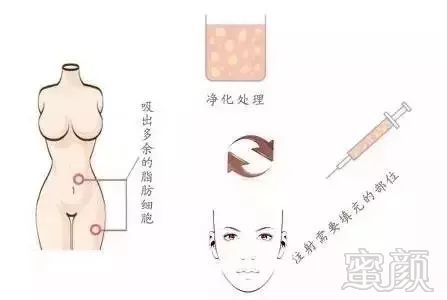 https://img.miyanlife.com/mnt/timg/180718/131932A07-9.jpg