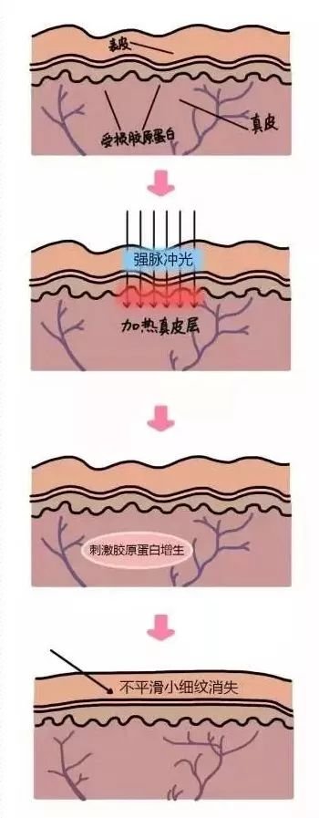 https://img.miyanlife.com/mnt/timg/180719/1112232949-3.jpg