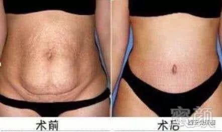 https://img.miyanlife.com/mnt/timg/180719/11304TT2-10.jpg