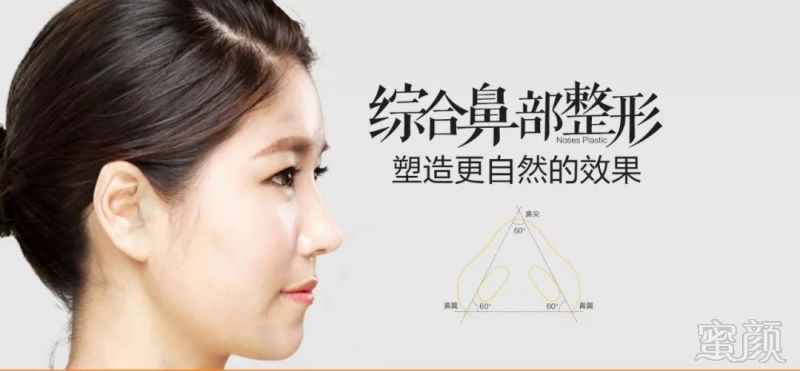 https://img.miyanlife.com/mnt/timg/180719/11341G208-3.jpg