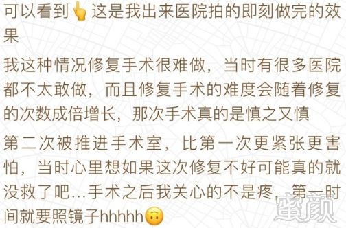 https://img.miyanlife.com/mnt/timg/180719/1135144W1-14.jpg