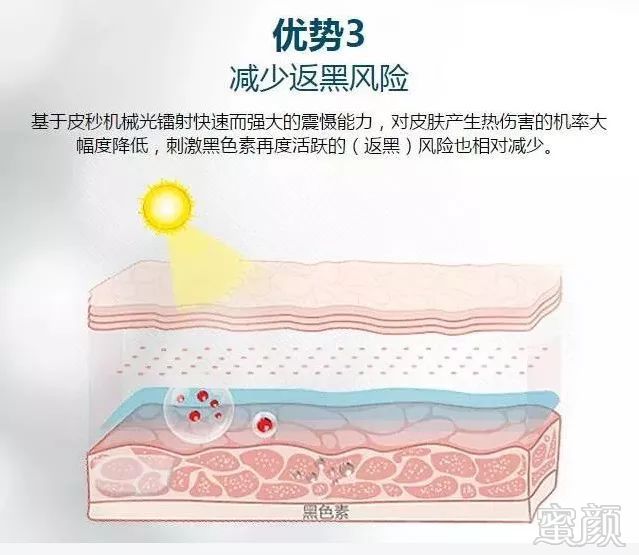 https://img.miyanlife.com/mnt/timg/180719/1144014044-11.jpg
