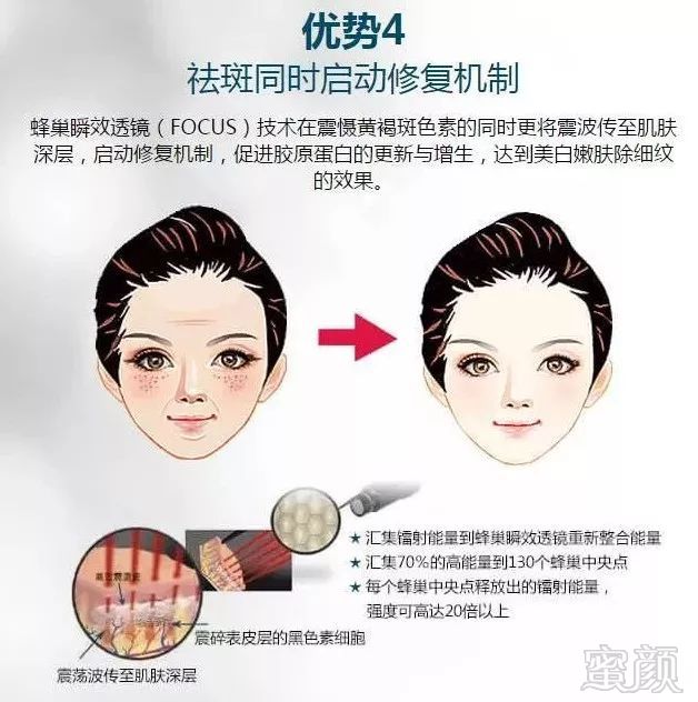 https://img.miyanlife.com/mnt/timg/180719/1144021441-12.jpg