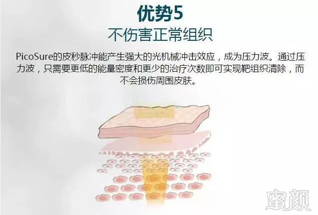 https://img.miyanlife.com/mnt/timg/180719/1144035912-13.jpg