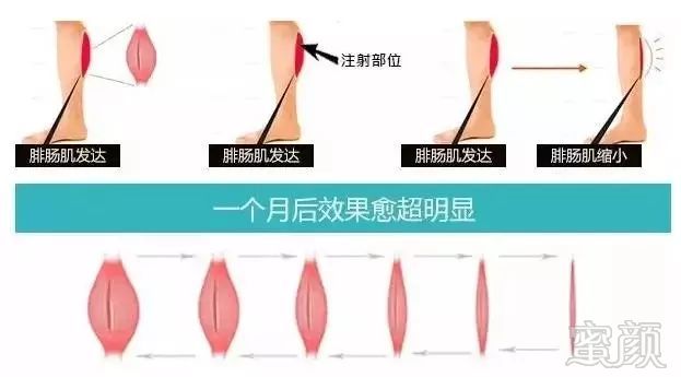 https://img.miyanlife.com/mnt/timg/180719/1209502541-11.jpg