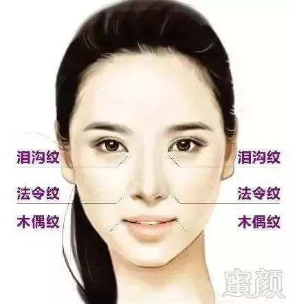 https://img.miyanlife.com/mnt/timg/180719/12105G964-3.jpg