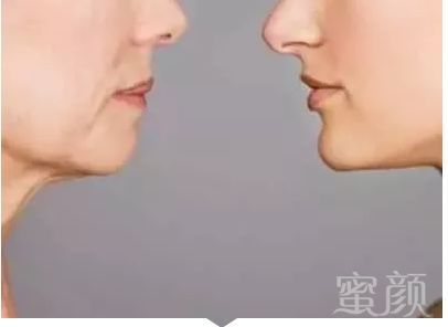 https://img.miyanlife.com/mnt/timg/180719/12105H511-4.jpg