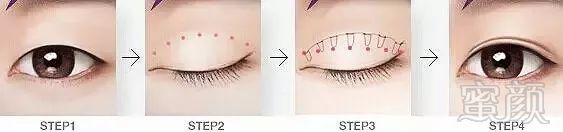 https://img.miyanlife.com/mnt/timg/180719/1214301010-3.jpg