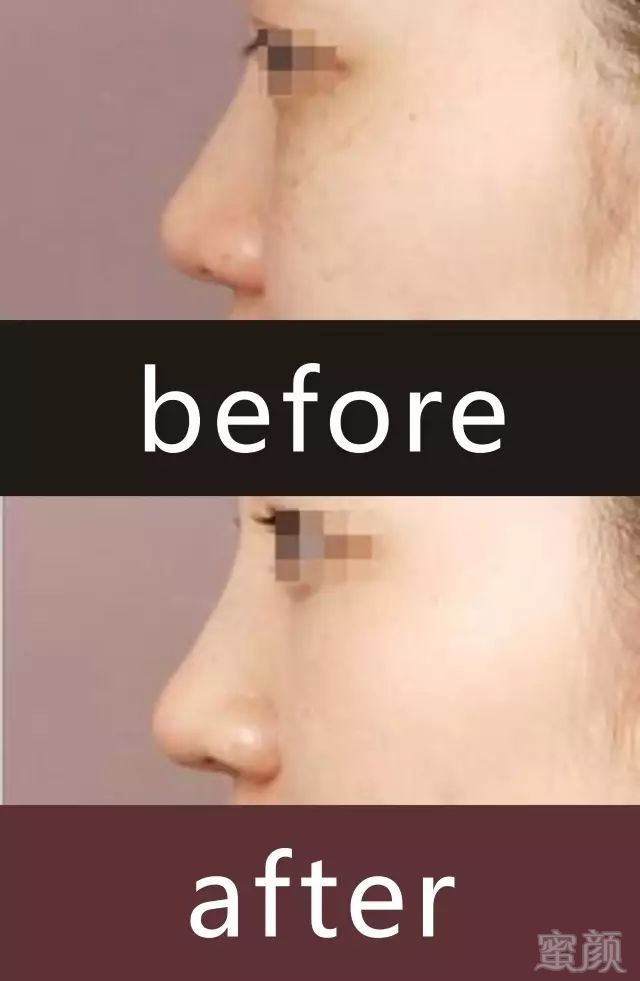 https://img.miyanlife.com/mnt/timg/180719/1220262257-4.jpg