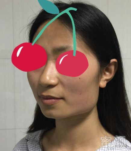 https://img.miyanlife.com/mnt/timg/180719/12234541Z-2.jpg