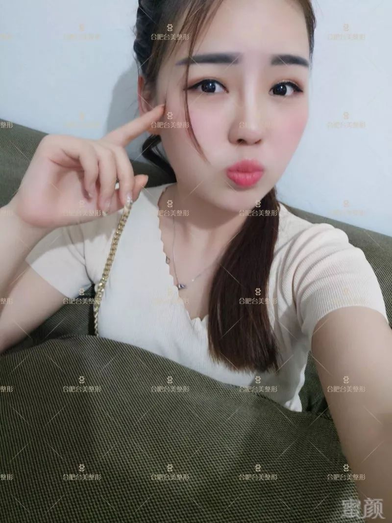 https://img.miyanlife.com/mnt/timg/180719/1225321H1-5.jpg