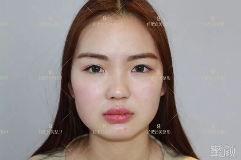https://img.miyanlife.com/mnt/timg/180719/1225324V1-3.jpg