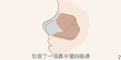 https://img.miyanlife.com/mnt/timg/180719/12311QH7-8.jpg