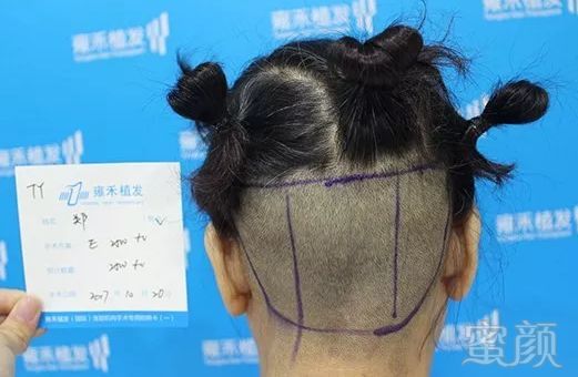 https://img.miyanlife.com/mnt/timg/180719/12333V524-2.jpg