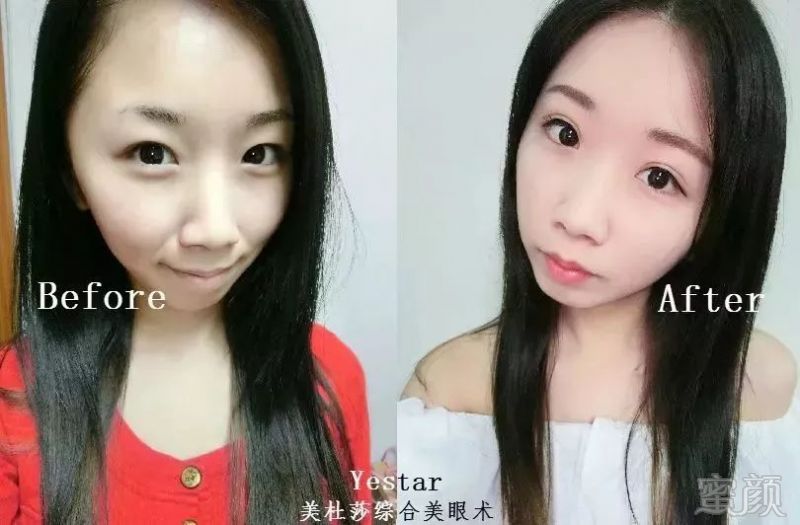 https://img.miyanlife.com/mnt/timg/180719/1234054326-0.jpg
