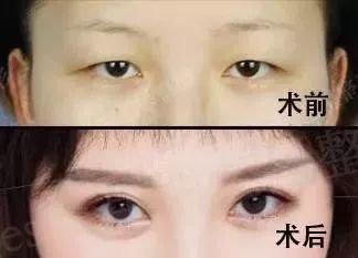 https://img.miyanlife.com/mnt/timg/180719/1234092134-9.jpg