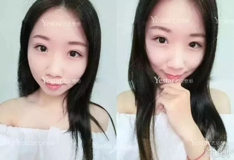 https://img.miyanlife.com/mnt/timg/180719/12340U4H-7.jpg