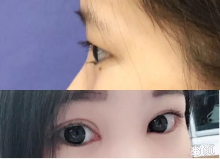 https://img.miyanlife.com/mnt/timg/180719/12341054X-10.jpg