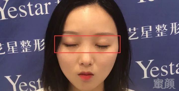 https://img.miyanlife.com/mnt/timg/180719/1234113I7-12.jpg