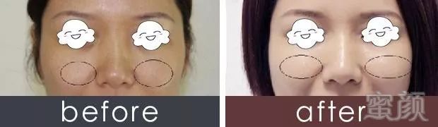 https://img.miyanlife.com/mnt/timg/180719/1240464442-7.jpg