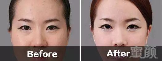 https://img.miyanlife.com/mnt/timg/180719/124F24054-6.jpg
