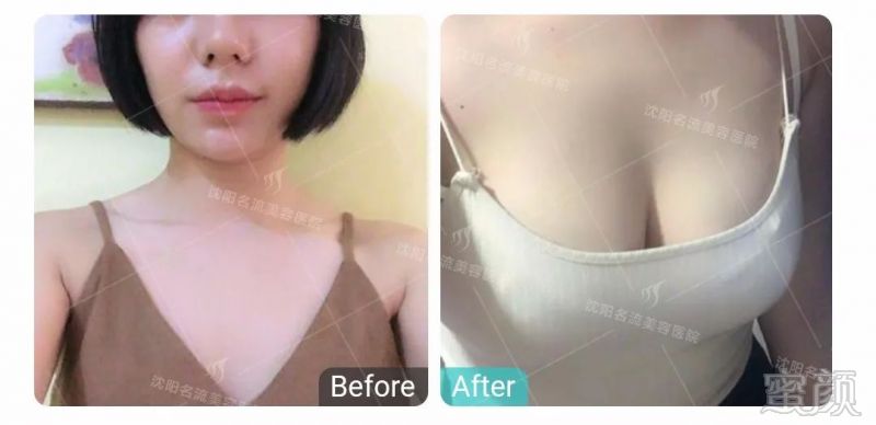 https://img.miyanlife.com/mnt/timg/180719/124F24260-9.jpg