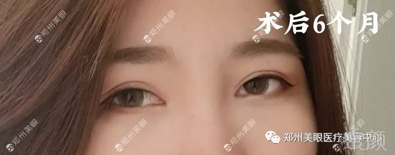 https://img.miyanlife.com/mnt/timg/180719/1250345F8-3.jpg
